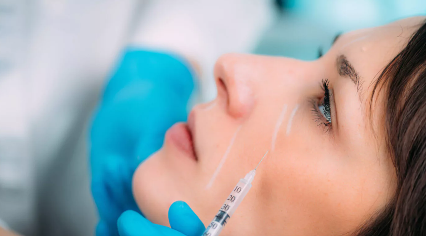 Gesicht einer Frau seitlich dargestellt mit einer Hyaluron-Spritze die von Händen mit blauen Hygienehandschuhen gehalten wird